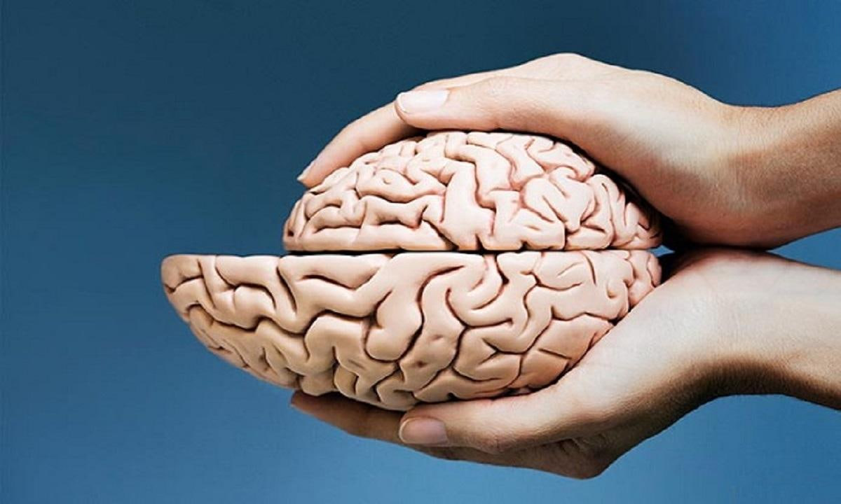 آلزایمر